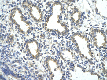 ZNF274 Rabbit Polyclonal Antibody