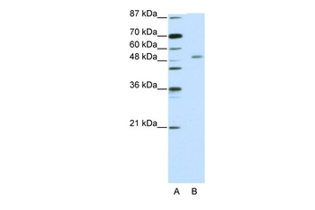 ZNF498 Rabbit Polyclonal Antibody
