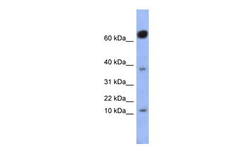 NKX6-3 Rabbit Polyclonal Antibody