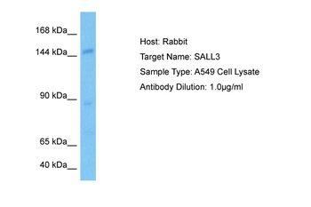 SALL3 Rabbit Polyclonal Antibody