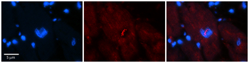 NFATC1 Rabbit Polyclonal Antibody