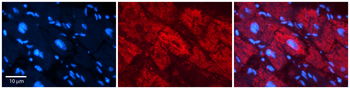 NFATC1 Rabbit Polyclonal Antibody