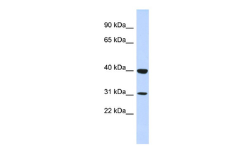 ZNF660 Rabbit Polyclonal Antibody