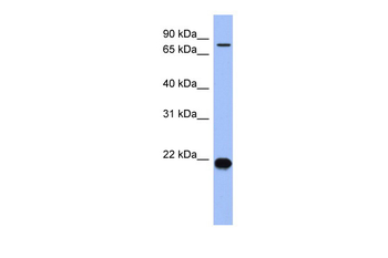 ZNF800 Rabbit Polyclonal Antibody