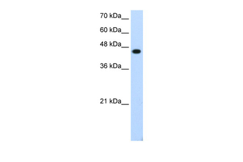 TFAP2E Rabbit Polyclonal Antibody