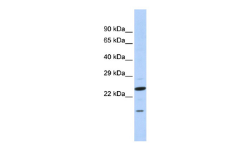 INSIG2 Rabbit Polyclonal Antibody