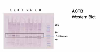 ACTB Rabbit Polyclonal Antibody
