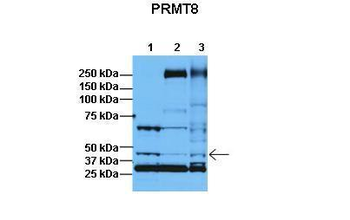 PRMT8 Rabbit Polyclonal Antibody