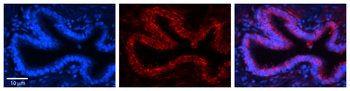 RPLP0 Rabbit Polyclonal Antibody