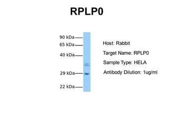 RPLP0 Rabbit Polyclonal Antibody