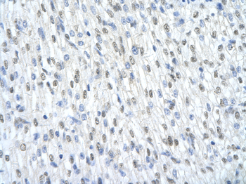 SF3B1 Rabbit Polyclonal Antibody