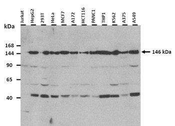 SF3B1 Rabbit Polyclonal Antibody