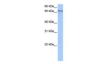 PABPC4 Rabbit Polyclonal Antibody