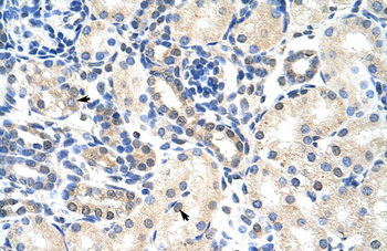 PABPC4 Rabbit Polyclonal Antibody