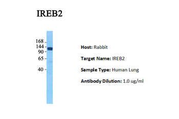 IREB2 Rabbit Polyclonal Antibody