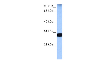 STAU1 Rabbit Polyclonal Antibody