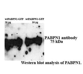 PABPN1 Rabbit Polyclonal Antibody