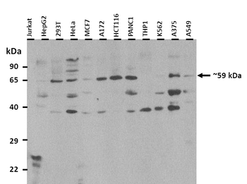 RBM39 Rabbit Polyclonal Antibody