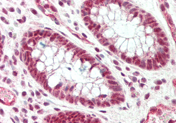 Srrm1 Rabbit Polyclonal Antibody