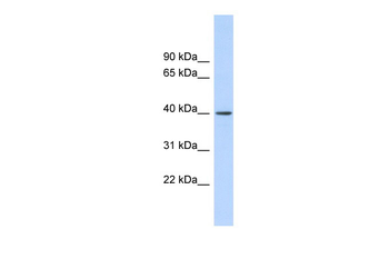 RAD51AP1 Rabbit Polyclonal Antibody