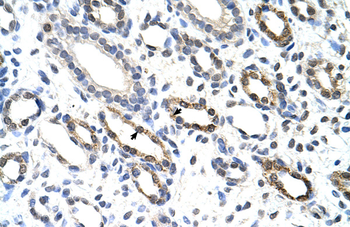 KHDRBS3 Rabbit Polyclonal Antibody