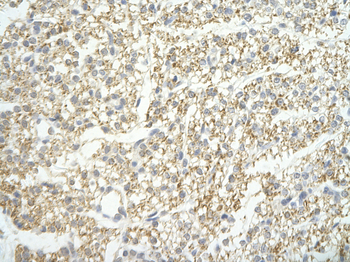 LSM4 Rabbit Polyclonal Antibody