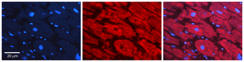SF3B1 Rabbit Polyclonal Antibody