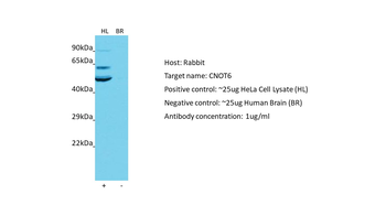 CNOT6 Rabbit Polyclonal Antibody