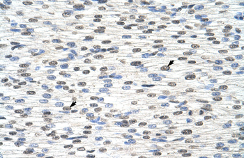RBM28 Rabbit Polyclonal Antibody