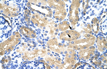 MTHFSD Rabbit Polyclonal Antibody