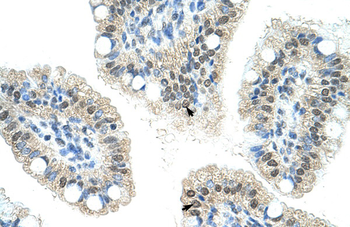 NOL6 Rabbit Polyclonal Antibody