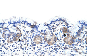 UPF3B Rabbit Polyclonal Antibody