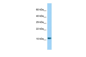 Lsm10 Rabbit Polyclonal Antibody