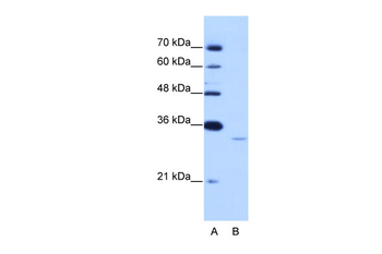 EXOSC6 Rabbit Polyclonal Antibody