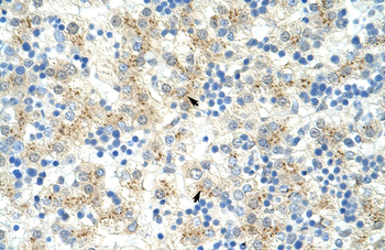 EXOSC6 Rabbit Polyclonal Antibody