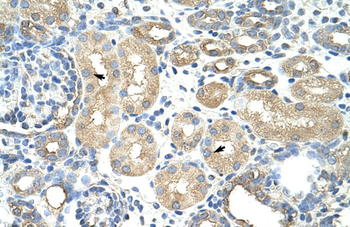 RAVER1 Rabbit Polyclonal Antibody