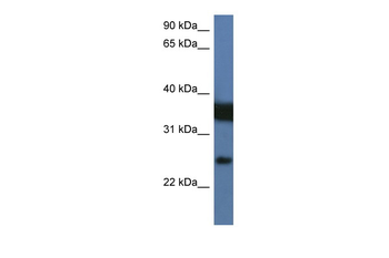 ZMAT2 Rabbit Polyclonal Antibody
