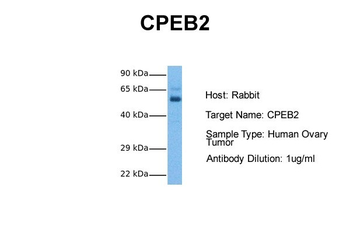 CPEB2 Rabbit Polyclonal Antibody