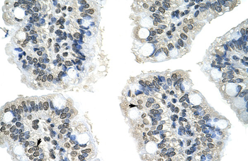 GIPC2 Rabbit Polyclonal Antibody