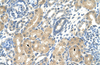 KHK Rabbit Polyclonal Antibody