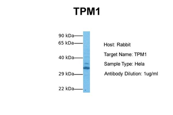 TPM1 Rabbit Polyclonal Antibody
