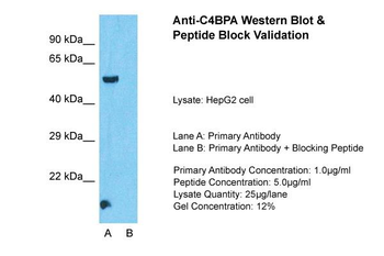 C4BPA Rabbit Polyclonal Antibody