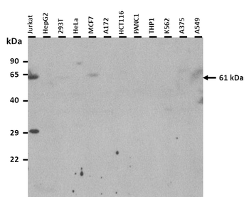 SLC22A1 Rabbit Polyclonal Antibody