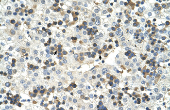 HSD17B6 Rabbit Polyclonal Antibody