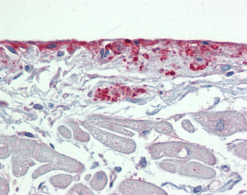 POSTN Rabbit Polyclonal Antibody