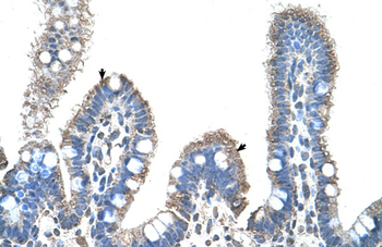 SLC22A1 Rabbit Polyclonal Antibody