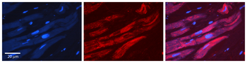 ALAD Rabbit Polyclonal Antibody