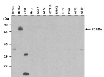 F2 Rabbit Polyclonal Antibody