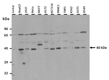 OTC Rabbit Polyclonal Antibody
