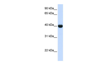 ADH1A Rabbit Polyclonal Antibody